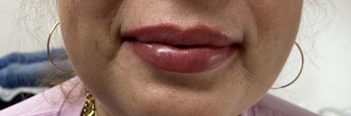 Lèvres maquillage permanent
